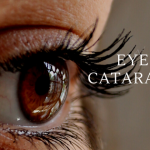 Cataract Surgery Myths